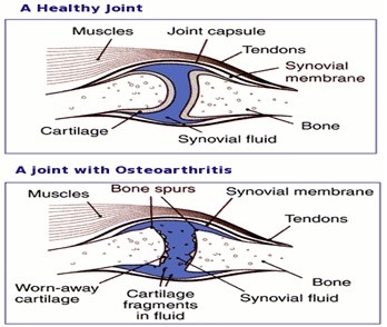 what is degenerative joint disease - symptoms - treatment